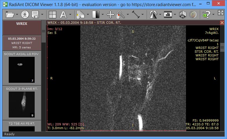 Visor DICOM radiante